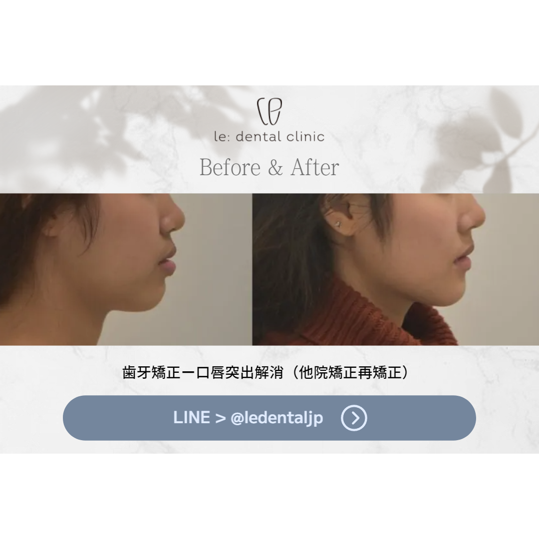 LE_Before&After_01