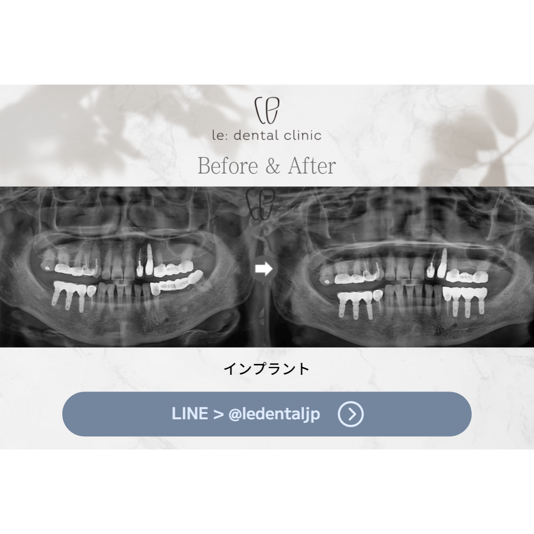 LE_Before&After_03
